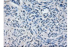 Immunohistochemical staining of paraffin-embedded endometrium tissue using anti-CYP2E1 mouse monoclonal antibody.