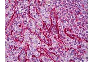 Anti-Vimentin antibody IHC of human spleen.