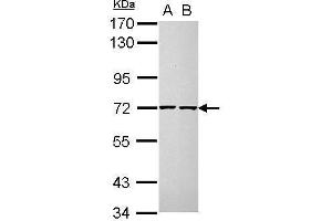 WB Image Sample (30 ug of whole cell lysate) A: H1299 B: MCF-7 7. (CDC25A Antikörper  (N-Term))