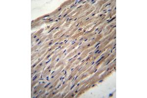 Immunohistochemistry (Paraffin-embedded Sections) (IHC (p)) image for anti-Procollagen-Lysine,2-Oxoglutarate 5-Dioxygenase 1 (PLOD1) (AA 66-94), (N-Term) antibody (ABIN656585)