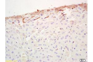 Formalin-fixed and paraffin embedded mouse liver labeled with Rabbit Anti FABP3/Cardiac FABP Polyclonal Antibody, Unconjugated (ABIN1387630) at 1:200 followed by conjugation to the secondary antibody and DAB staining (FABP3 Antikörper  (AA 8-100))