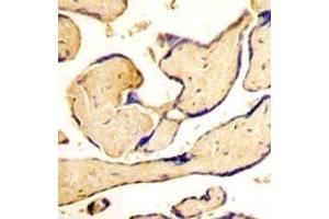 IHC analysis of FFPE human placenta tissue stained with EphA3 antibody (EPH Receptor A3 Antikörper  (AA 896-928))