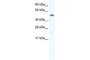 WB Suggested Anti-ELP4 Antibody Titration:  2. (ELP4 Antikörper  (Middle Region))