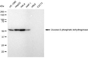 Western blotting analysis using Glucose-6-phosphate dehydrogenase antibody (ABIN7798733).