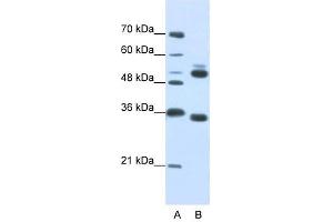 WDR6 antibody used at 0. (WDR6 Antikörper  (C-Term))