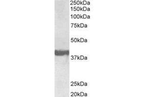 AP32034PU-N Endophilin-A1 Antibody staining of Human Frontal Cortex lysate at 0.