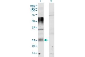 Western Blot analysis of TMEM123 expression in transfected 293T cell line by TMEM123 monoclonal antibody (M02), clone 1F4. (TMEM123 Antikörper  (AA 34-133))