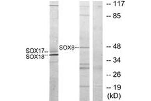 Western blot analysis of extracts from COS7 cells, treated with serum 10% 30', using SOX8/9/17/18 Antibody. (SOX8/9/17/18 Antikörper  (AA 116-165))