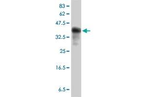 Western Blot detection against Immunogen (40. (IFITM3 Antikörper  (AA 1-133))