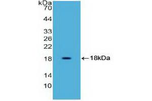 Western blot analysis of recombinant Human HMGA1. (HMGA1 Antikörper  (AA 3-107))