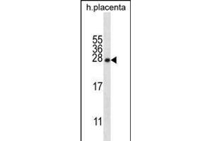 CRYBA1 Antibody (Center) (ABIN656311 and ABIN2845613) western blot analysis in human placenta tissue lysates (35 μg/lane). (CRYBA1 Antikörper  (AA 104-133))