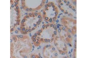 Used in DAB staining on fromalin fixed paraffin- embedded Kidney tissue (HPS4 Antikörper  (AA 6-192))