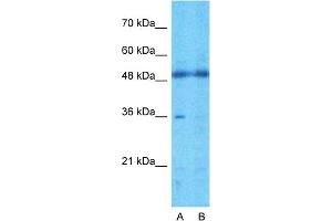 Host:  Rabbit  Target Name:  TMEM30A  Sample Type:  721_B  Lane A:  Primary Antibody  Lane B:  Primary Antibody + Blocking Peptide  Primary Antibody Concentration:  1ug/ml  Peptide Concentration:  5ug/ml  Lysate Quantity:  25ug/lane/lane  Gel Concentration:  0. (TMEM30A Antikörper  (Middle Region))