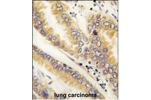 Immunohistochemistry (Paraffin-embedded Sections) (IHC (p)) image for anti-Anterior Gradient Homolog 2 (Xenopus Laevis) (AGR2) (AA 13-42), (N-Term) antibody (ABIN390226)