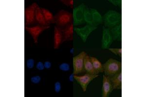 MSK2 Mouse Monoclonal Antibody staining Hela cells by IF/ICC.
