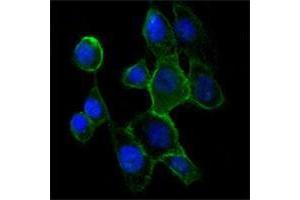 Immunofluorescence analysis of A431 cells using CDH2 antibody (green). (N-Cadherin Antikörper)