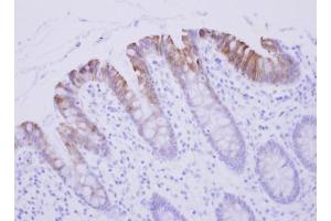 IHC-P Image Biglycan antibody detects BGN protein at cytosol on human Colon Epithelium by immunohistochemical analysis. (Biglycan Antikörper)
