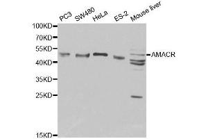 Western blot analysis of extracts of various cell lines, using AMACR antibody. (AMACR Antikörper  (AA 1-198))