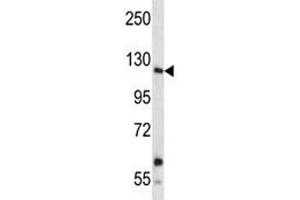 Insulin receptor R antibody western blot analysis in A549 lysate. (INSRR Antikörper  (AA 1228-1255))