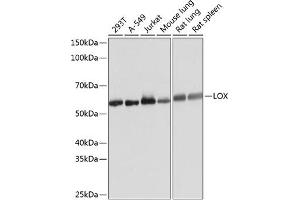 Western blot analysis of extracts of various cell lines, using LOX Rabbit mAb (ABIN7268347) at 1:1000 dilution. (LOX Antikörper)