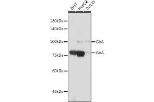 Western blot analysis of extracts of various cell lines, using GAA antibody (ABIN7267404) at 1:1000 dilution. (GAA Antikörper)