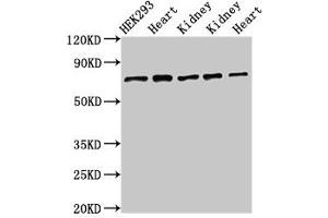 Western Blot Positive WB detected in: HEK293 whole cell lysate, Rat heart tissue, Rat kidney tissue, Mouse kidney tissue, Mouse heart tissue All lanes: SLC25A12 antibody at 3 μg/mL Secondary Goat polyclonal to rabbit IgG at 1/50000 dilution Predicted band size: 75, 63 kDa Observed band size: 75 kDa (SLC25A12 Antikörper  (AA 202-317))