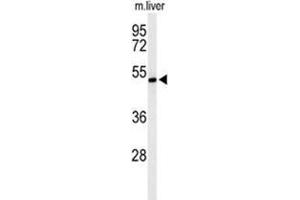 Western blot analysis of ZDHHC9 Antibody (C-term) in mouse liver tissue lysates (35 µg/lane). (ZDHHC9 Antikörper  (C-Term))