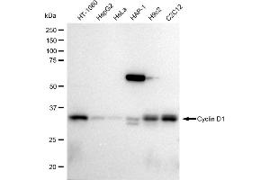 Western blotting analysis using Cyclin D1 antibody (ABIN7798194). (Rekombinanter Cyclin D1 Antikörper)