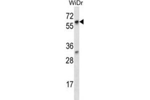 Western Blotting (WB) image for anti-La Ribonucleoprotein Domain Family, Member 7 (LARP7) antibody (ABIN2997066) (LARP7 Antikörper)