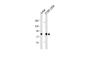 All lanes : Anti-MYB Antibody (Center) at 1:2000 dilution Lane 1: Jurkat whole cell lysate Lane 2: CCRF-CEM whole cell lysate Lysates/proteins at 20 μg per lane. (MYB Antikörper  (AA 1-185))