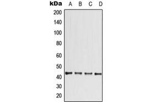 Western blot analysis of CCBE1 expression in ACHN (A), HeLa (B), SP2/0 (C), PC12 (D) whole cell lysates. (CCBE1 Antikörper  (Center))