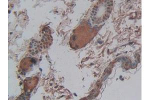 Used in DAB staining on fromalin fixed paraffin- embedded intestine tissue (CPB2 Antikörper  (AA 113-422))