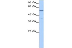 Western Blotting (WB) image for anti-Choline Kinase alpha (CHKA) antibody (ABIN2463572) (Choline Kinase alpha Antikörper)