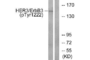 Western blot analysis of extracts from HUVEC cells, treated with EGF (200ng/ml, 30mins), using HER3/ErbB3 (Phospho-Tyr1222) antibody. (ERBB3 Antikörper  (pTyr1222))