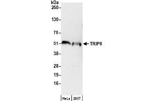 Western Blotting (WB) image for anti-Thyroid Hormone Receptor Interactor 6 (TRIP6) (AA 200-250) antibody (ABIN7449173)