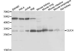 Western blot analysis of extracts of various cell lines, using CLIC4 antibody (ABIN5974262) at 1/1000 dilution. (CLIC4 Antikörper)