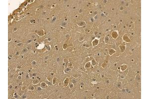 NMDAR2B Mouse Monoclonal Antibody at 1/100 staining mouse brain tissue by IHC-P. (GRIN2B Antikörper  (C-Term))