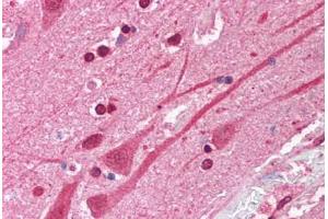 Human Brain, Cortex (formalin-fixed, paraffin-embedded) stained with ATF1 antibody ABIN214086 at 5 ug/ml followed by biotinylated goat anti-rabbit IgG secondary antibody ABIN481713, alkaline phosphatase-streptavidin and chromogen. (AFT1 Antikörper  (N-Term))