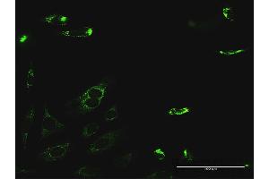 Immunofluorescence of purified MaxPab antibody to PYCR2 on HeLa cell. (PYCR2 Antikörper  (AA 1-320))
