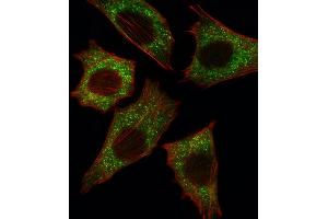 Fluorescent image of C2C12 cell stained with BRAF Antibody (Center) (ABIN392246 and ABIN2841936).