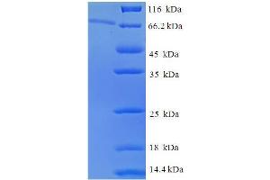 SDS-PAGE (SDS) image for Epoxide Hydrolase 1, Microsomal (Xenobiotic) (EPHX1) (AA 1-455), (full length) protein (His-SUMO Tag) (ABIN5709473)