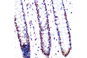 Immunohistochemistry of paraffin-embedded human colon using SRSF1/SRSF1/SF2/ASF Rabbit mAb (ABIN7270213) at dilution of 1:100 (40x lens). (SRSF1 Antikörper)