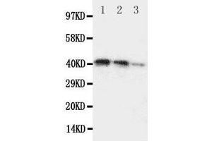 Lane 3: Recombinant Human DDR2 Protein 2. (DDR2 Antikörper  (C-Term))