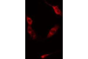 ABIN6275854 staining  Hela cells by IF/ICC. (PKN1 Antikörper  (Internal Region))