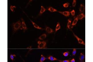 Immunofluorescence analysis of NIH-3T3 cells using PTPN13 Polyclonal Antibody at dilution of 1:100 (40x lens). (PTPN13 Antikörper)