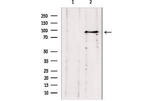 Western blot analysis of extracts from HepG2, using ODF2 antibody. (ODF2 Antikörper  (Internal Region))