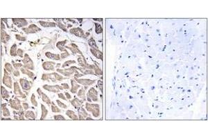 Immunohistochemistry analysis of paraffin-embedded human heart tissue, using BRWD3 Antibody. (BRWD3 Antikörper  (AA 1751-1800))