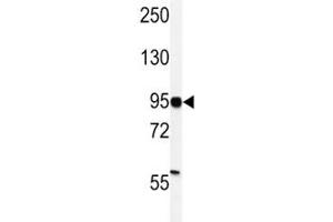 Western blot analysis of HIF-1 alpha antibody and MDA-MB231 lysate (HIF1A Antikörper  (AA 728-757))