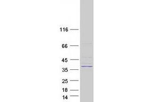 Validation with Western Blot (MAGEF1 Protein (Myc-DYKDDDDK Tag))