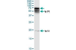 Immunoprecipitation of GALNS transfected lysate using anti-GALNS MaxPab rabbit polyclonal antibody and Protein A Magnetic Bead , and immunoblotted with GALNS MaxPab rabbit polyclonal antibody (D01) . (GALNS Antikörper  (AA 1-522))